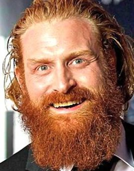 Diễn viên Kristofer Hivju